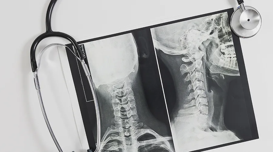 X Ray