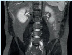 Magnetic Resonance Imaging (MRI)