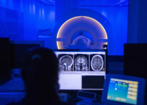 Benefits of MRI